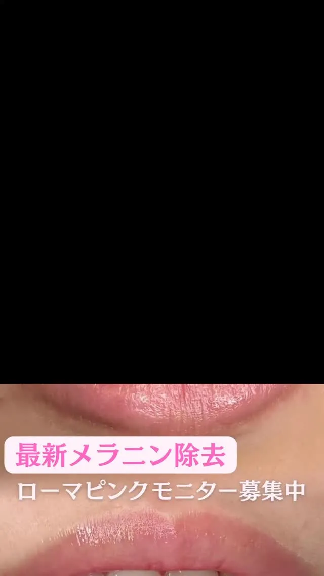 ローマピンク『リップ』症例写真💋